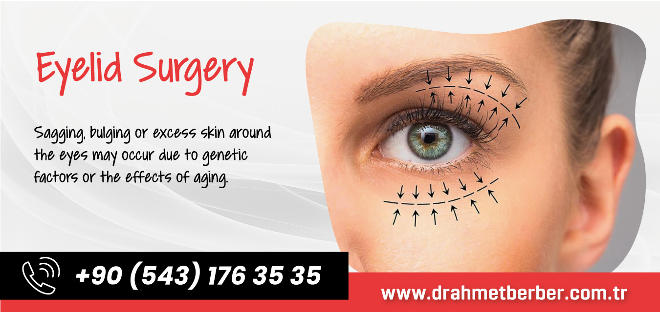 Eyelid Surgery